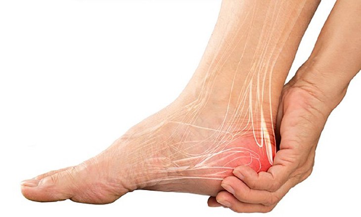 triệu chứng đau nhức gót chân