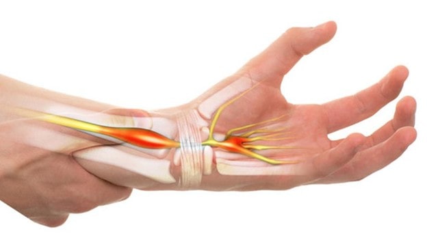đau nhức xương cánh tay phải là bệnh gì